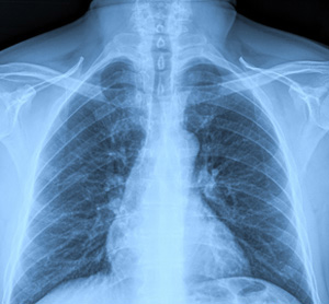 X-Ray Image