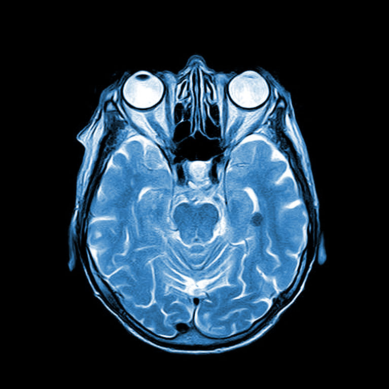 Brain MRI image Brain MRI image